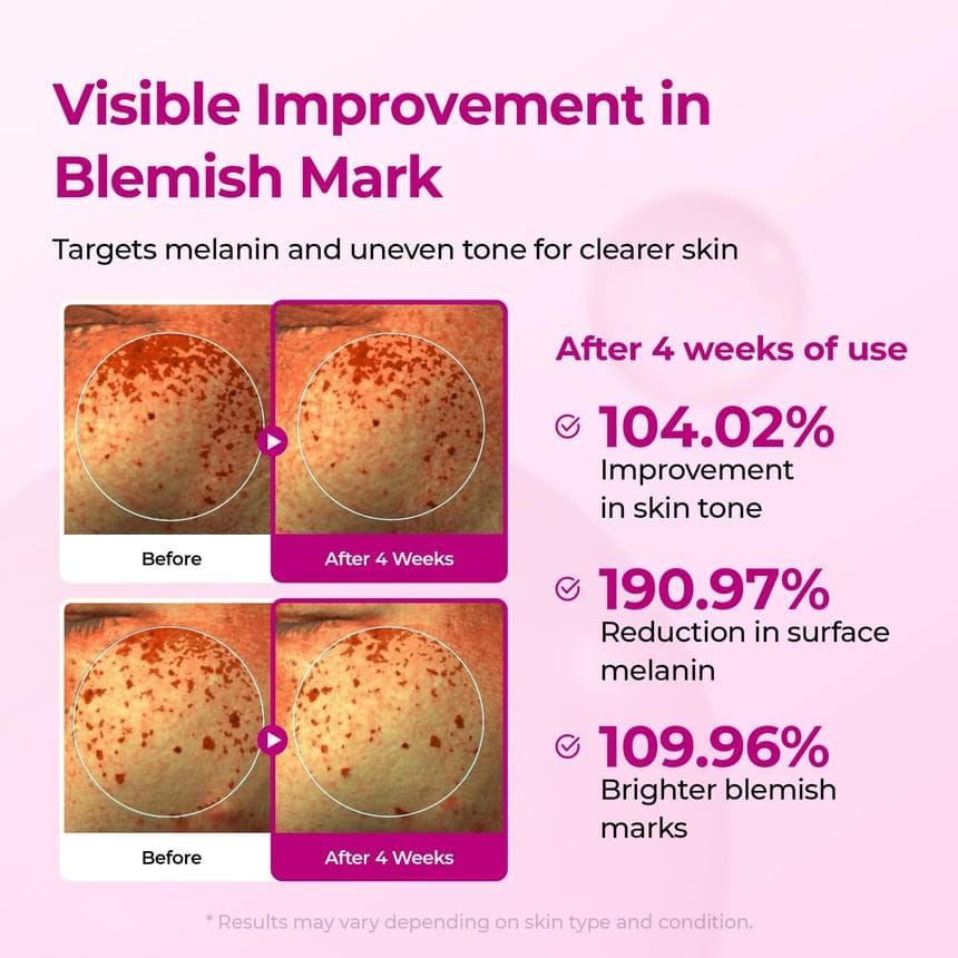 Cemenrete Serum Combo