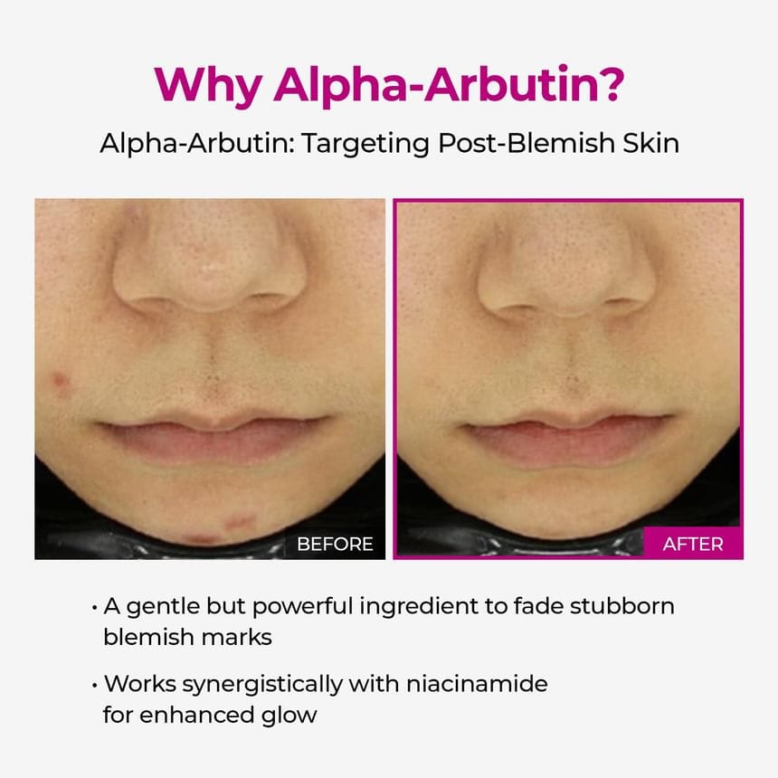 Cemenrete Serum Combo