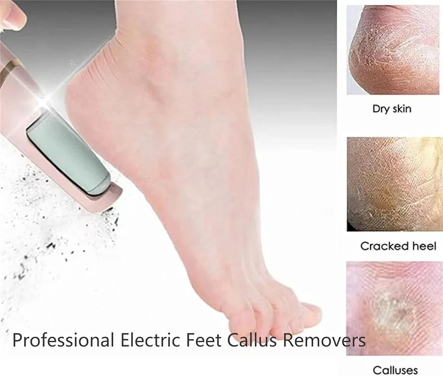 Electric Callus Remover for Feet